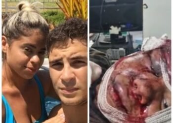 Barbaridade: sem pode falar, mulher espancada por ex-namorado dentro de elevador se comunica por escrito com policiais em hospital de Natal-RN 