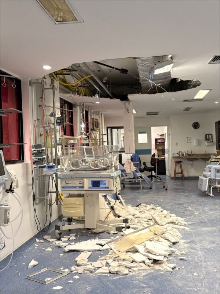 Forro do teto desabado na UTI pediátrica do Hospital Barão